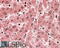 Major Histocompatibility Complex, Class II, DQ Alpha 2 antibody, 42-668, ProSci, Western Blot image 