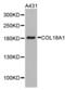 Collagen Type XVIII Alpha 1 Chain antibody, abx001439, Abbexa, Western Blot image 