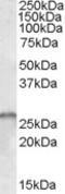 Patatin Like Phospholipase Domain Containing 2 antibody, 45-306, ProSci, Enzyme Linked Immunosorbent Assay image 