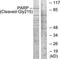 Poly(ADP-Ribose) Polymerase 1 antibody, LS-C121098, Lifespan Biosciences, Western Blot image 