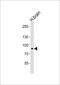 Ankyrin repeat domain-containing protein 20B antibody, PA5-49369, Invitrogen Antibodies, Western Blot image 