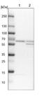 Coenzyme A Synthase antibody, NBP1-84990, Novus Biologicals, Western Blot image 