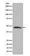 Serpin Family H Member 1 antibody, M03050-1, Boster Biological Technology, Western Blot image 