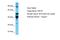Keratin 34 antibody, A15070, Boster Biological Technology, Western Blot image 