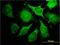 Aldolase, Fructose-Bisphosphate A antibody, H00000226-M01, Novus Biologicals, Immunofluorescence image 