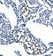 Eukaryotic Translation Termination Factor 1 antibody, M04157-1, Boster Biological Technology, Immunohistochemistry paraffin image 
