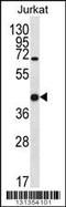 Galectin 4 antibody, 56-392, ProSci, Western Blot image 