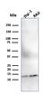 Beta-2-Microglobulin antibody, GTX34436, GeneTex, Western Blot image 