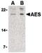 TLE Family Member 5, Transcriptional Modulator antibody, PA5-20170, Invitrogen Antibodies, Western Blot image 