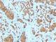 Melan-A antibody, NBP2-44387, Novus Biologicals, Immunohistochemistry frozen image 