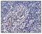 Heat Shock Protein 90 Alpha Family Class A Member 1 antibody, M01103-4, Boster Biological Technology, Immunohistochemistry paraffin image 
