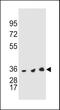 Thymidylate Synthetase antibody, MBS9201073, MyBioSource, Western Blot image 