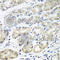 HLA class II histocompatibility antigen, DM beta chain antibody, A8384, ABclonal Technology, Immunohistochemistry paraffin image 