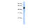 TRNA Methyltransferase 2 Homolog B antibody, 26-362, ProSci, Enzyme Linked Immunosorbent Assay image 