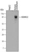 ADAM Metallopeptidase Domain 22 antibody, MA5-24210, Invitrogen Antibodies, Western Blot image 