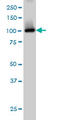 Phosphodiesterase 2A antibody, LS-C197857, Lifespan Biosciences, Western Blot image 