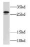 RAB26, Member RAS Oncogene Family antibody, FNab07008, FineTest, Western Blot image 