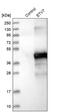 ETS Variant 7 antibody, PA5-56042, Invitrogen Antibodies, Western Blot image 