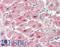 Pim-2 Proto-Oncogene, Serine/Threonine Kinase antibody, LS-B10471, Lifespan Biosciences, Immunohistochemistry frozen image 