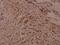 WNK1 antibody, A01422T60, Boster Biological Technology, Immunohistochemistry frozen image 