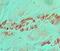 Snail Family Transcriptional Repressor 1 antibody, PA5-23482, Invitrogen Antibodies, Immunohistochemistry paraffin image 