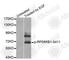 Ribosomal Protein S6 Kinase B1 antibody, AP0246, ABclonal Technology, Western Blot image 