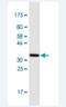 Metallothionein 3 antibody, H00004504-M02-100ug, Novus Biologicals, Western Blot image 