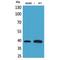 Troponin T2, Cardiac Type antibody, LS-C387133, Lifespan Biosciences, Western Blot image 