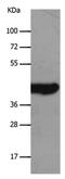 Solute Carrier Family 16 Member 7 antibody, PA5-50518, Invitrogen Antibodies, Western Blot image 