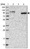 Signal Induced Proliferation Associated 1 Like 2 antibody, PA5-55004, Invitrogen Antibodies, Western Blot image 