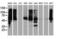 IlvB Acetolactate Synthase Like antibody, NBP2-00883, Novus Biologicals, Western Blot image 