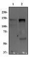 Fibroblast Growth Factor Receptor 1 antibody, NB100-2080, Novus Biologicals, Western Blot image 