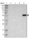 CaM Kinase Like Vesicle Associated antibody, NBP1-82660, Novus Biologicals, Western Blot image 