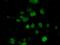 EMG1 N1-Specific Pseudouridine Methyltransferase antibody, MA5-25111, Invitrogen Antibodies, Immunocytochemistry image 