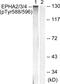 EPH Receptor A2 antibody, AP55721PU-S, Origene, Western Blot image 