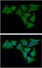 Crystallin Alpha B antibody, GTX57544, GeneTex, Immunofluorescence image 
