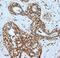 L-lactate dehydrogenase A chain antibody, PA5-19754, Invitrogen Antibodies, Immunohistochemistry frozen image 