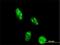 DOT1 Like Histone Lysine Methyltransferase antibody, H00084444-M01, Novus Biologicals, Immunocytochemistry image 