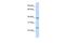 Claudin 7 antibody, GTX47786, GeneTex, Western Blot image 