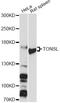 Tonsoku Like, DNA Repair Protein antibody, LS-C748101, Lifespan Biosciences, Western Blot image 