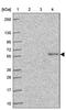 Solute Carrier Family 29 Member 3 antibody, PA5-63045, Invitrogen Antibodies, Western Blot image 