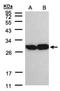 Triosephosphate Isomerase 1 antibody, orb73702, Biorbyt, Western Blot image 