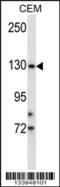 Transmembrane Serine Protease 9 antibody, 57-416, ProSci, Western Blot image 