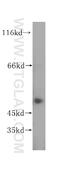 Protein Phosphatase, Mg2+/Mn2+ Dependent 1F antibody, 17020-1-AP, Proteintech Group, Western Blot image 
