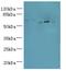 Adenosine Deaminase TRNA Specific 1 antibody, A58022-100, Epigentek, Western Blot image 