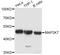 Mitogen-Activated Protein Kinase Kinase 7 antibody, A0528, ABclonal Technology, Western Blot image 