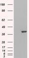 GRB2 Related Adaptor Protein 2 antibody, MBS420932, MyBioSource, Western Blot image 