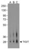 T Cell Immunoreceptor With Ig And ITIM Domains antibody, RF16054, ProSci, Western Blot image 