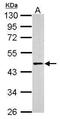 Adrenoceptor Beta 2 antibody, PA5-27083, Invitrogen Antibodies, Western Blot image 
