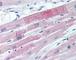 Eukaryotic Translation Initiation Factor 4E antibody, 49-237, ProSci, Immunohistochemistry paraffin image 
